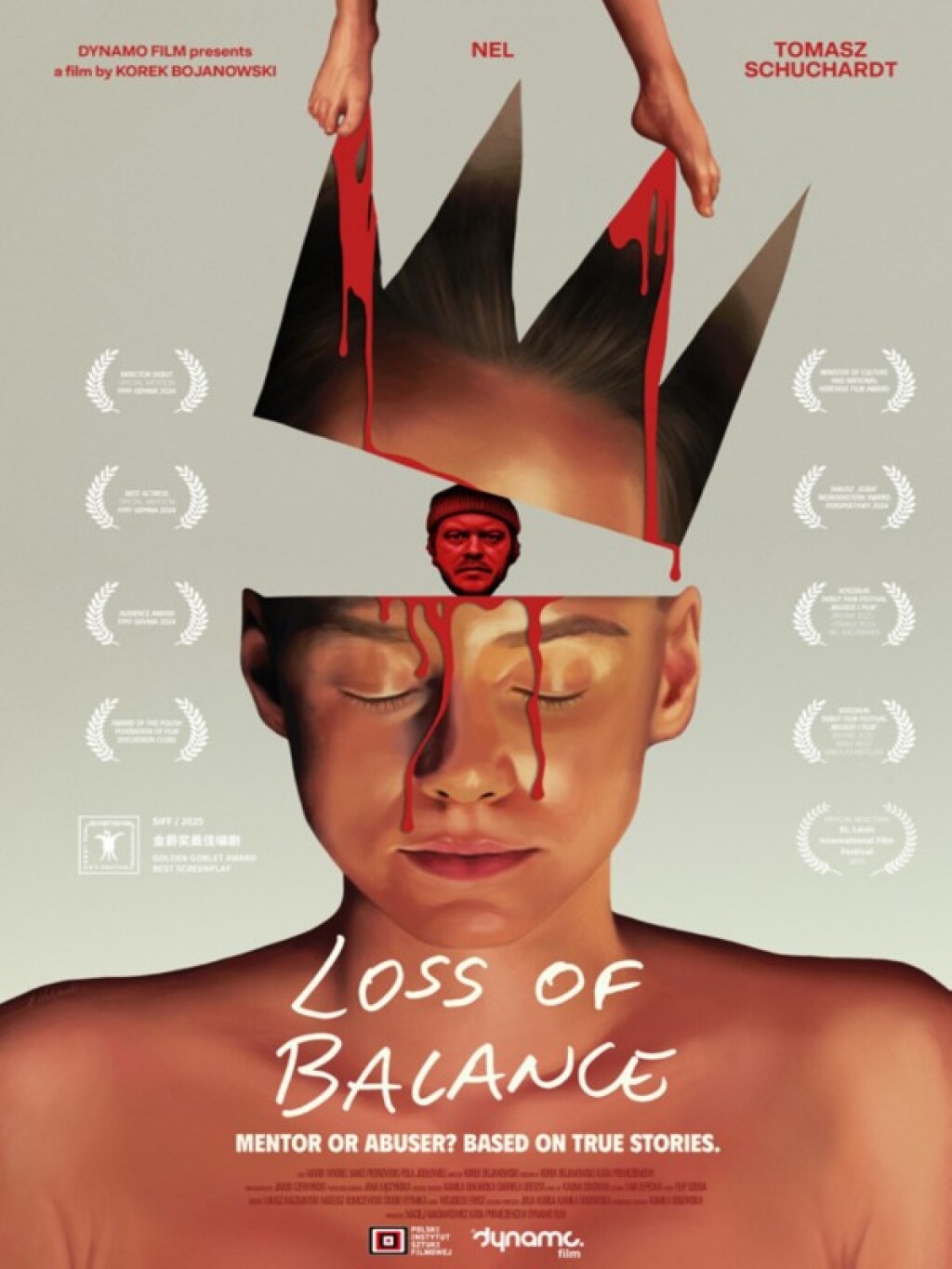 Denge Kaybı - Loss Of Balance